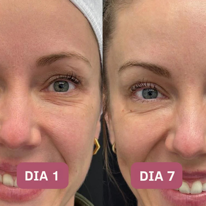 Quia | Crema De Colageno Para Firmeza Y Manchas